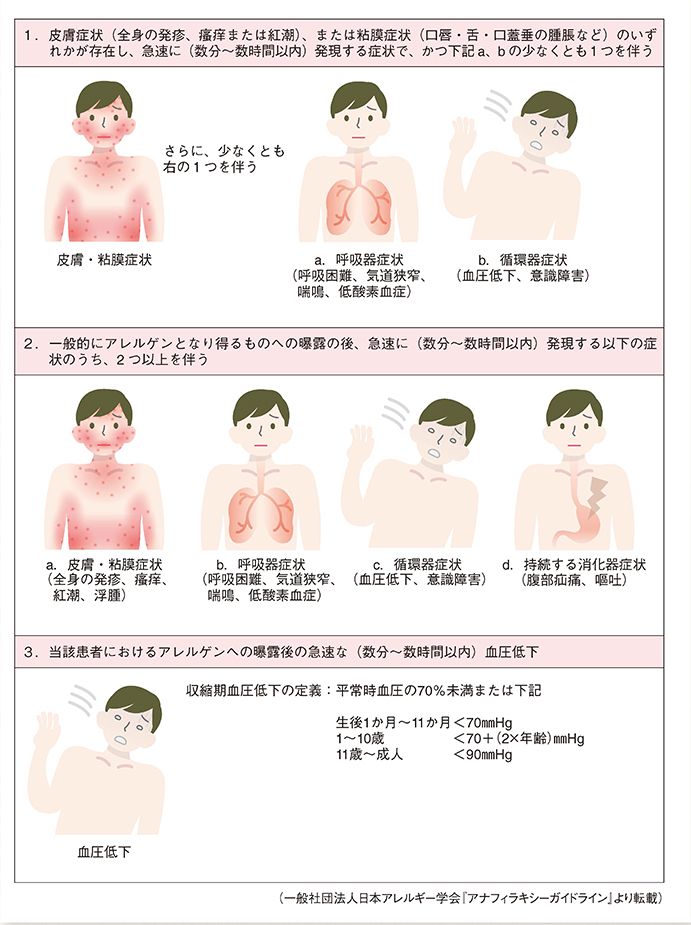 アレルギー 症状 大豆